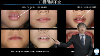 小児の不正咬合を引き起こす口腔習癖 アイコンで見える化する