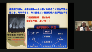 歯科人生を楽しくする咬合調整【咬合調整の理論 咬合調整法の実際】の画像です。