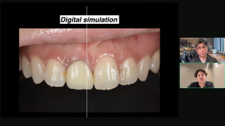 補綴治療をよりスムーズに成功させるためのAtoZの画像です。