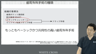 ここからはじめよう超ベーシック歯周外科の画像です。