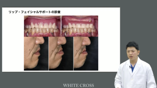 Under40 僕らの時代のインプラントオーバーデンチャーという選択肢の画像です。