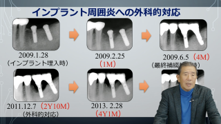 「口から始める健康長寿」～検査・診断の極み～の画像です。