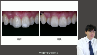 【第1回】理論・導入編の画像です。