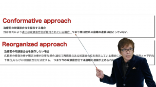 EPISODE2：補綴咬合のための4要素の画像です。