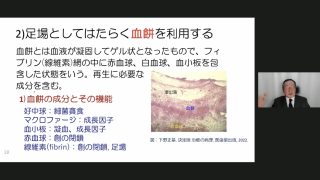 治癒の病理 ペリオ・インプラントの疑問を解決！下野先生が考える最新