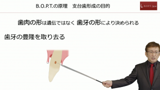第1回 臨床の場を広げる 公式B.O.P.T.コンセプト その症例と誤解しやすい留意点の画像です。