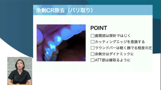 外れることなく超精密かつ最速のアタッチメント設置が実現！年間