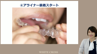 マウスピース矯正を導入しよう！〜メリットデメリットからクロージングの方法まで〜の画像です。