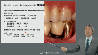 藤本補綴臨床研修会 補綴・インプラント総合マネージメント