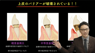 歯周治療を成功させるための基礎と臨床～チームワークで歯周病に立ち向かう～の画像です。