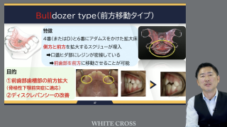ゼロから始める小児矯正システムBASICの画像です。