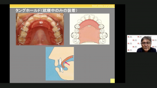 6歳から機能を改善する床矯正 | WHITE CROSS