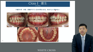 いつから、なにから、どうやればいい？1からわかる小児矯正治療の基本の画像です。