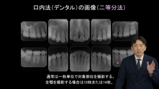 歯科衛生士がおさえるべきデンタル・パノラマの基本 | WHITE CROSS