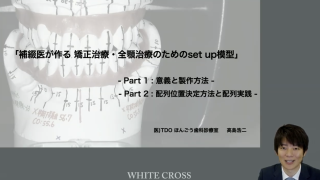 補綴医が作る 矯正治療・全顎治療のための「SET UP 模型」part1の画像です。