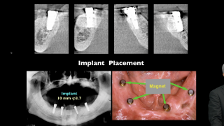 【第2回】臨床編の画像です。