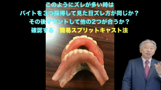 前歯でも噛める入れ歯研究会「かみつきがいい」入れ歯 自立支援歯科学編の画像です。