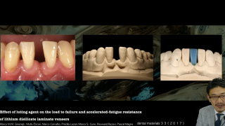 成功するMI審美修復の画像です。