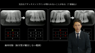 歯周組織再生療法を『成功』に導くマネジメント（2days） | WHITE CROSS