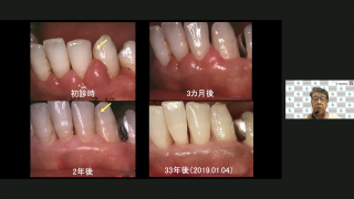 明日から実践 歯周基本治療を極める！の画像です。
