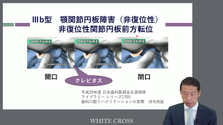 標準 顎関節症の基礎と臨床2023〜基礎編〜 | WHITE CROSS