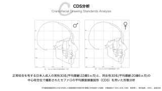 ペリオの視点からみた、ガミースマイルの体系的な治療計画の画像です。