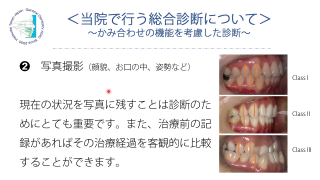 【第2回】咬合診断に欠かせない資料集めの真髄の画像です。