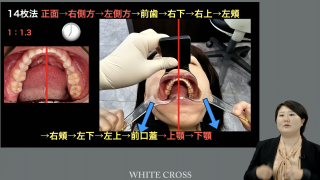 歯科衛生士は活用するべき！〜口腔内写真の可能性〜の画像です。