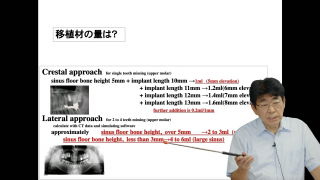 【前編】の画像です。