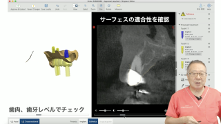 ADDで学ぶ、デジタルトランスフォーメーション～補綴、インプラント、矯正への応用～の画像です。