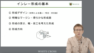 インレー形成〜第3回 新人ドクター 迷い・失敗 気づいて欲しいポイント〜の画像です。