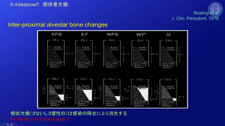 歯周外科治療・歯周組織再生療法の画像です。
