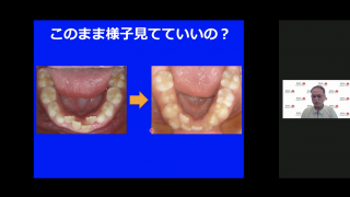 歯科から食育を発信しよう！ ～噛むことの効用とスポーツドリンクの虚像～の画像です。