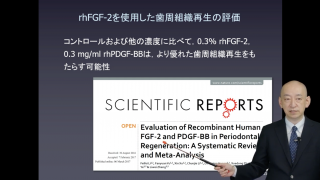 ここまで来た！歯周組織再生療法の現在の画像です。