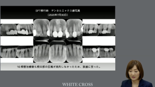 そのちょっと変わった歯周炎、どう治す？の画像です。