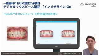 一般歯科における矯正の必要性 デジタルマウスピース矯正 『インビザラインGo』の画像です。