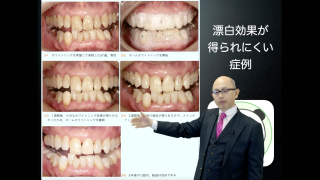 ホワイトニングを知りたい歯科医院が見るセミナー Live版〜歯科医師・歯科衛生士のお悩み・疑問をズバッ！と解決！書籍大ヒットによる特別企画！〜の画像です。