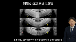 CBCT画像のメリット、生かせていますか？の画像です。