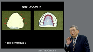 楽しく分かりやすい総義歯製作法〜『総義歯の病理』より名人芸を必要と