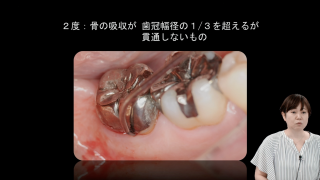 SRPを理解しよう！〜初級編〜の画像です。