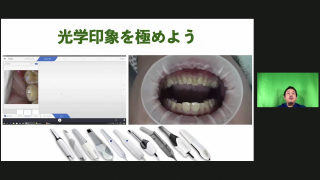 IOS光学印象完全攻略の画像です。