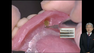 【第1回】基礎編の画像です。