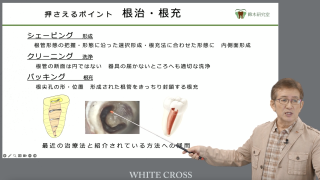 歯内療法・支台築造〜第4回 新人ドクター 迷い・失敗 気づいて欲しいポイント〜の画像です。