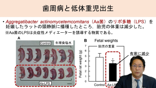 【誰もが深く理解していない】妊婦歯科健診・食育の重要性の画像です。