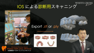 現代デジタルインプラント治療の基礎知識〜「診査診断」から「手術」「補綴」までを全てデジタルで行うことは可能か？〜の画像です。