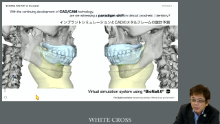 顎運動可視化技術からみる次世代歯科医療の展望 | WHITE CROSS