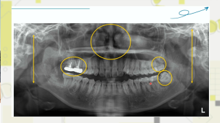 【前編】の画像です。