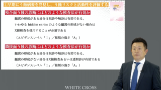 レジン充填の最初の一歩〜Ⅰ級窩洞〜の画像です。