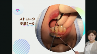 どこをどうやってSRPする？〜検査・根面探知・キュレット操作を極める〜の画像です。