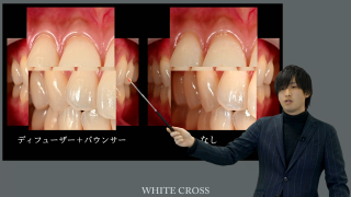 SNS新時代に映える！症例写真の撮り方の画像です。